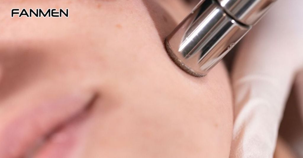 Điều trị sẹo rỗ bằng phương pháp mài da vi điểm