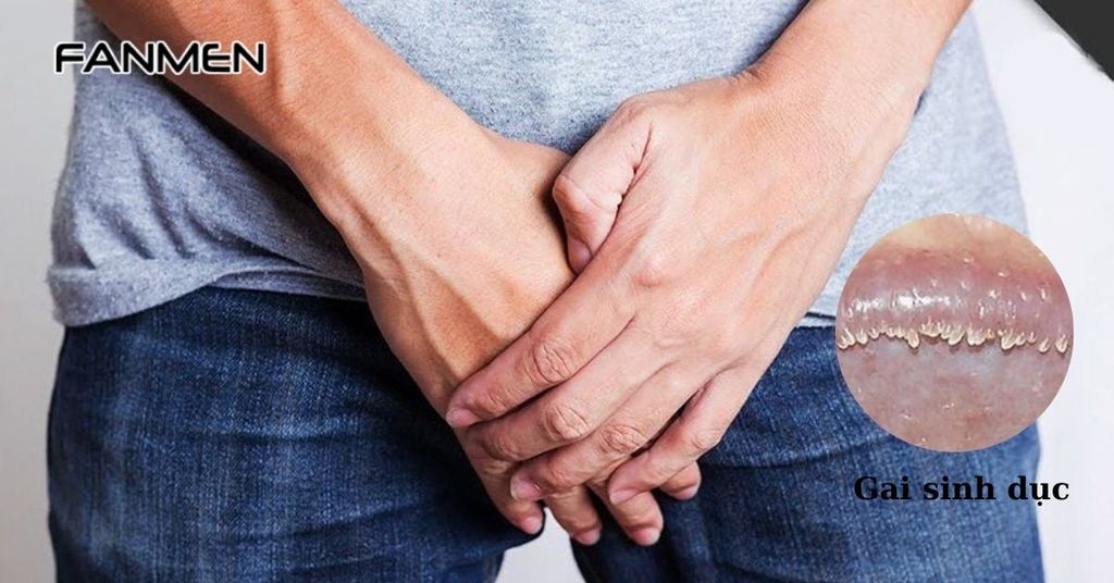 Gai sinh dục
