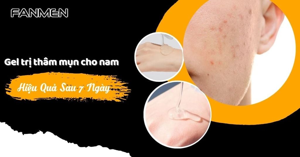 Gel trị thâm mụn cho nam