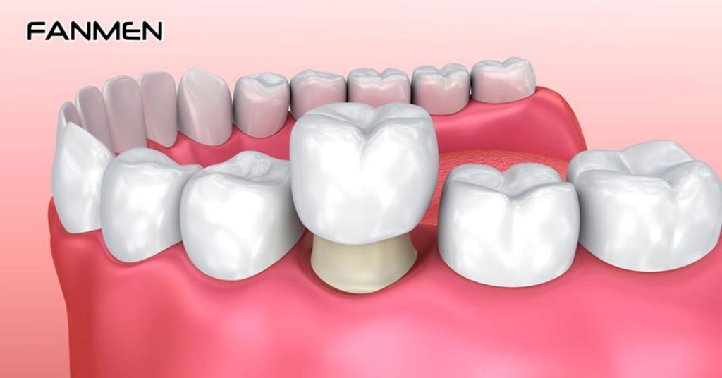Cách Phòng Ngừa Tình Trạng Bọc Răng Sứ Bị Hôi Miệng