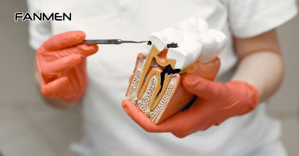 Hôi miệng do nguồn gốc răng miệng