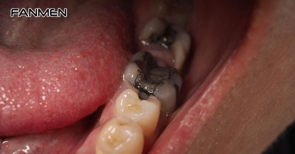 Nguyên nhân hôi miệng xuất phát từ vấn đề răng miệng