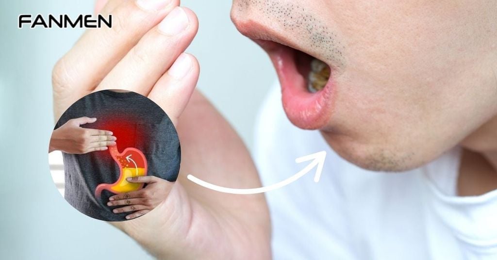 Hôi miệng hở van dạ dày là gì?