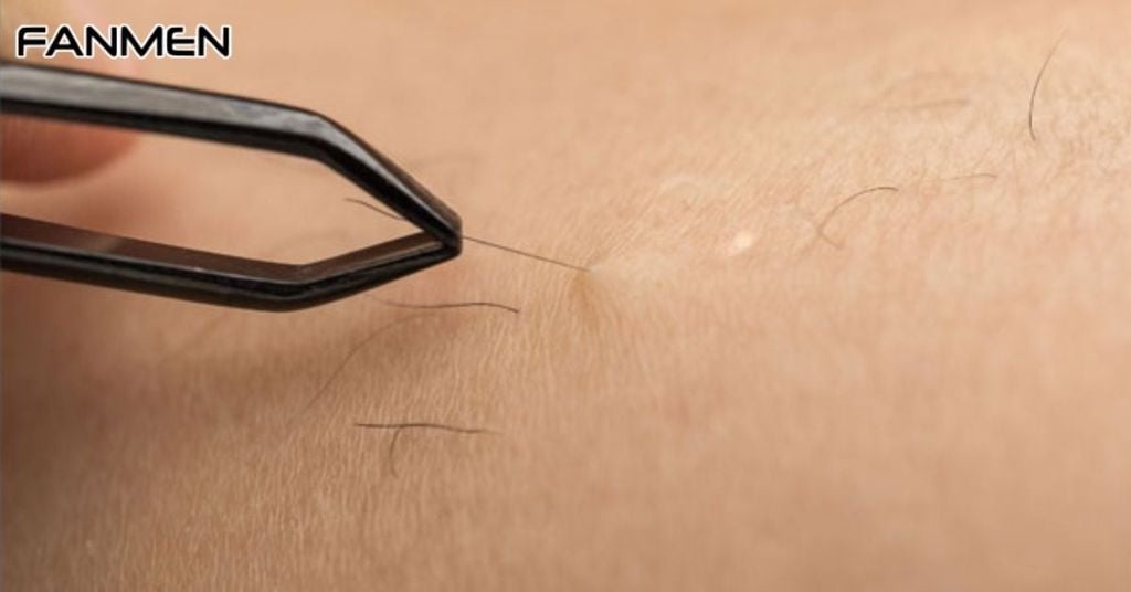 Hướng Dẫn Cách Nhổ Lông Vùng Kín Nam