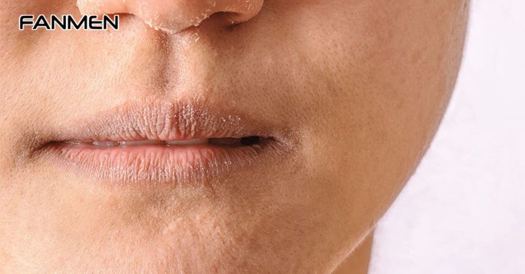 Không tẩy tế bào chết