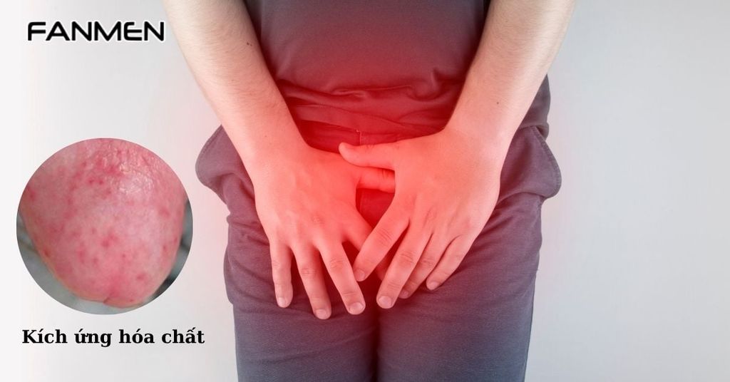 Kích ứng bởi hóa chất