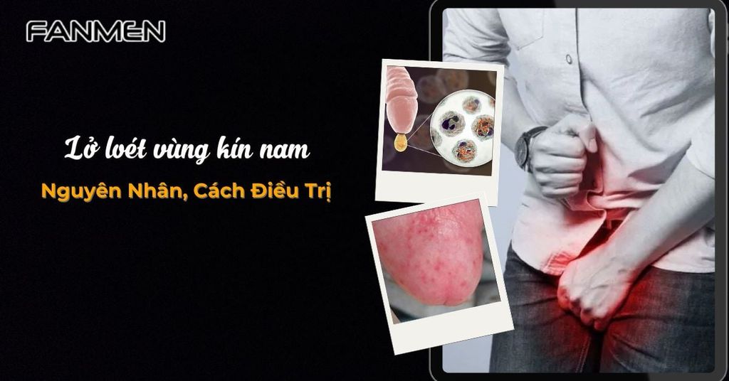 Lở loét vùng kín nam
