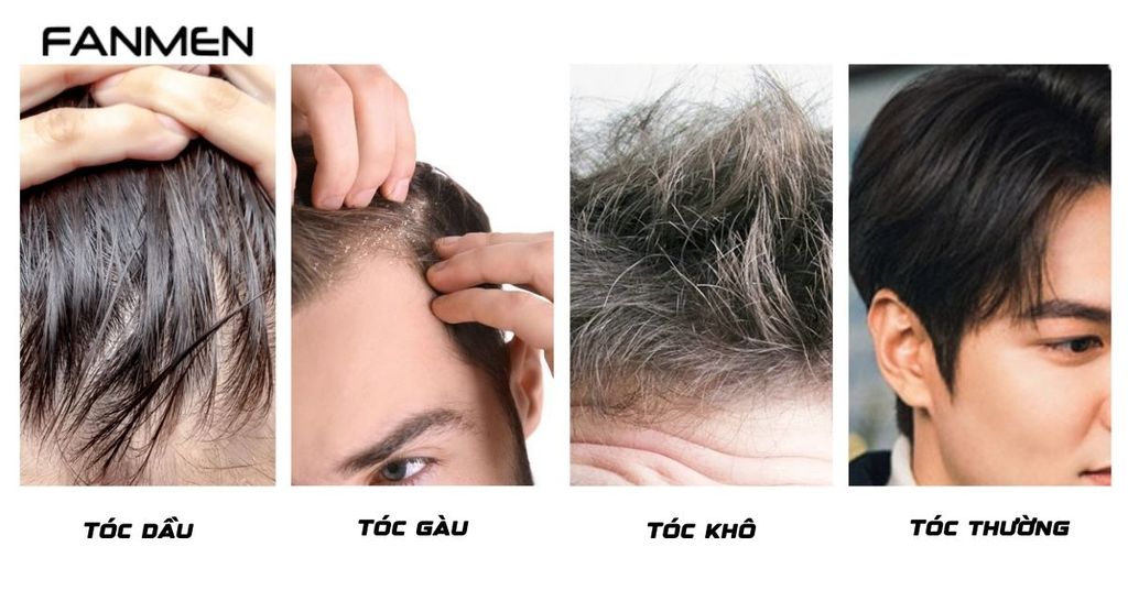 Loại tóc nam giới