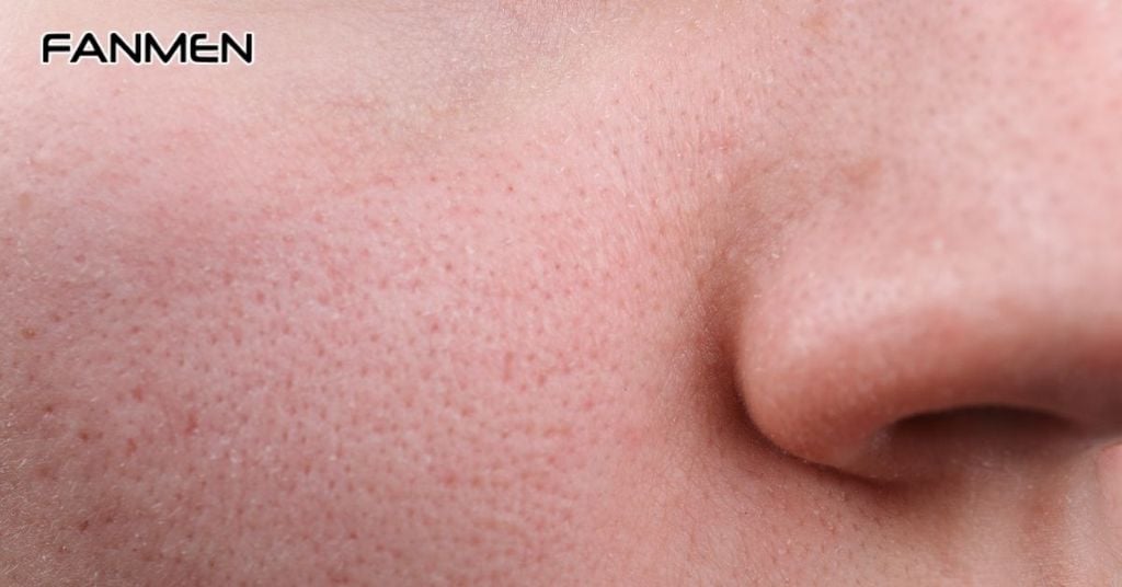 Nguyên nhân gây ra tình trạng da mặt nam giới bị khô