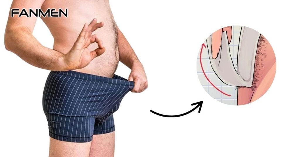 Tẩy lông vùng kín nam tại nhà bằng phương pháp Waxing