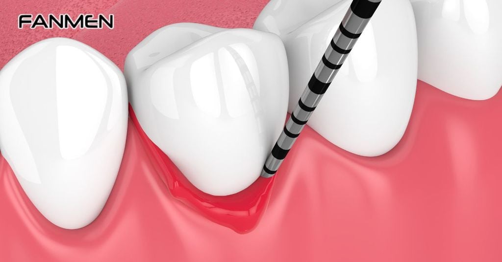 Các nguyên nhân xuất phát từ vấn đề răng miệng