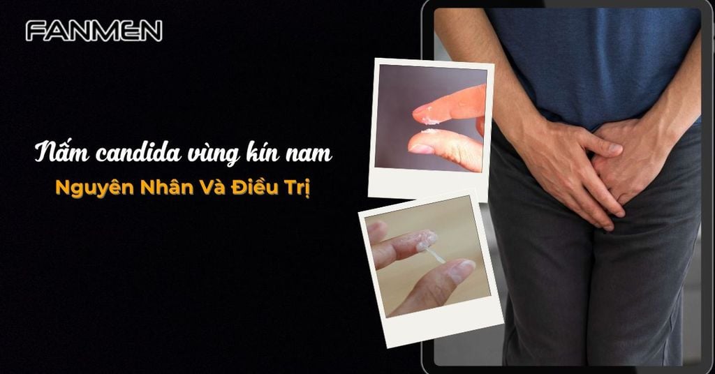Nấm candida vùng kín nam