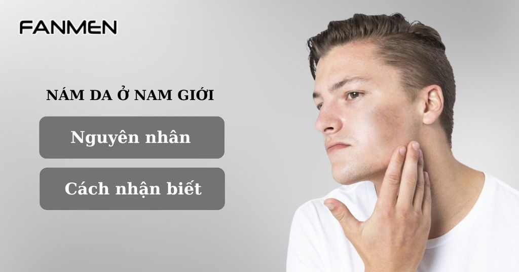 Nám da là gì? Nguyên nhân và cách nhận biết