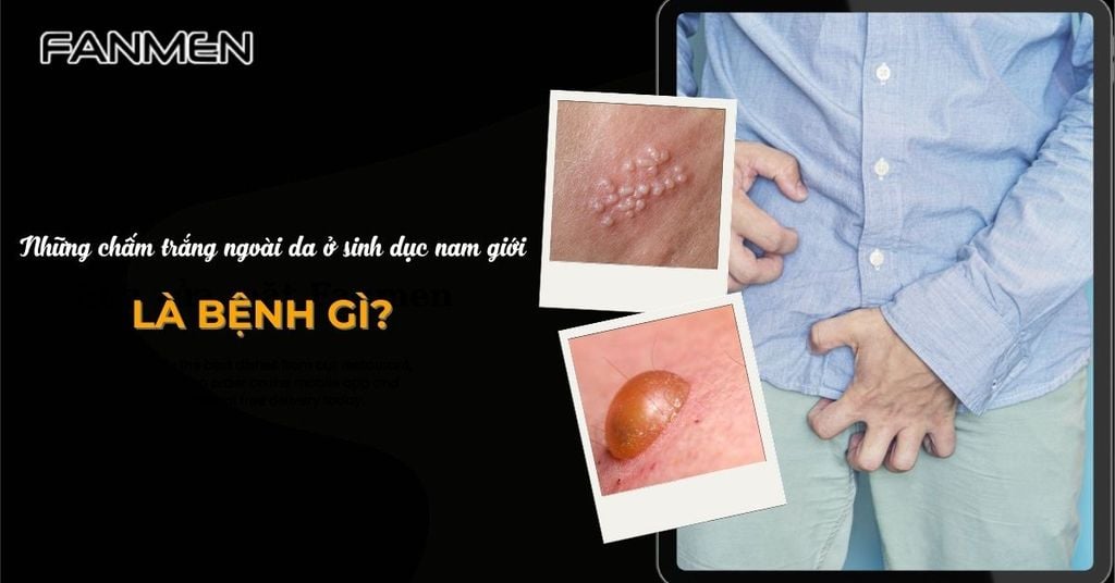 những chấm trắng ngoài da ở sinh dục nam giới