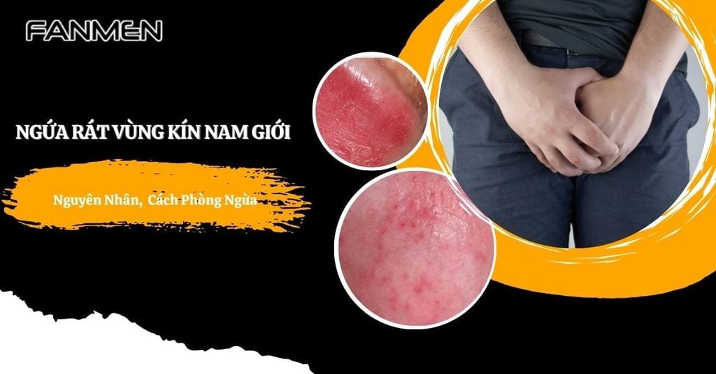 ngứa rát vùng kín nam giới