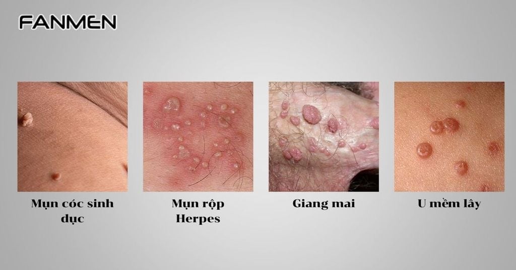 Nguyên nhân do bệnh lý