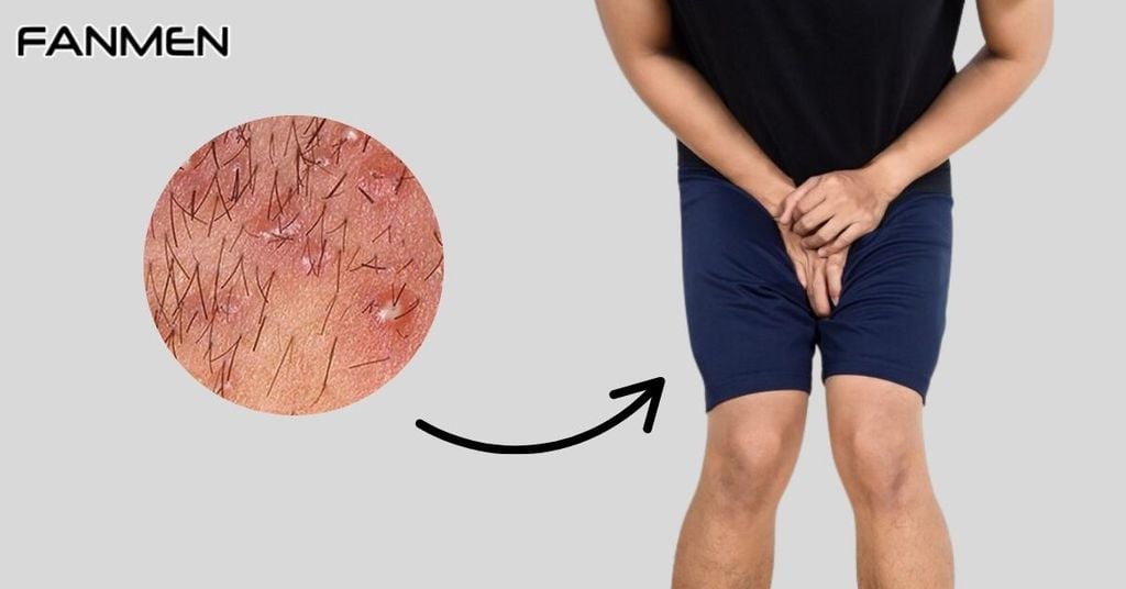 Nguyên nhân do sinh lý