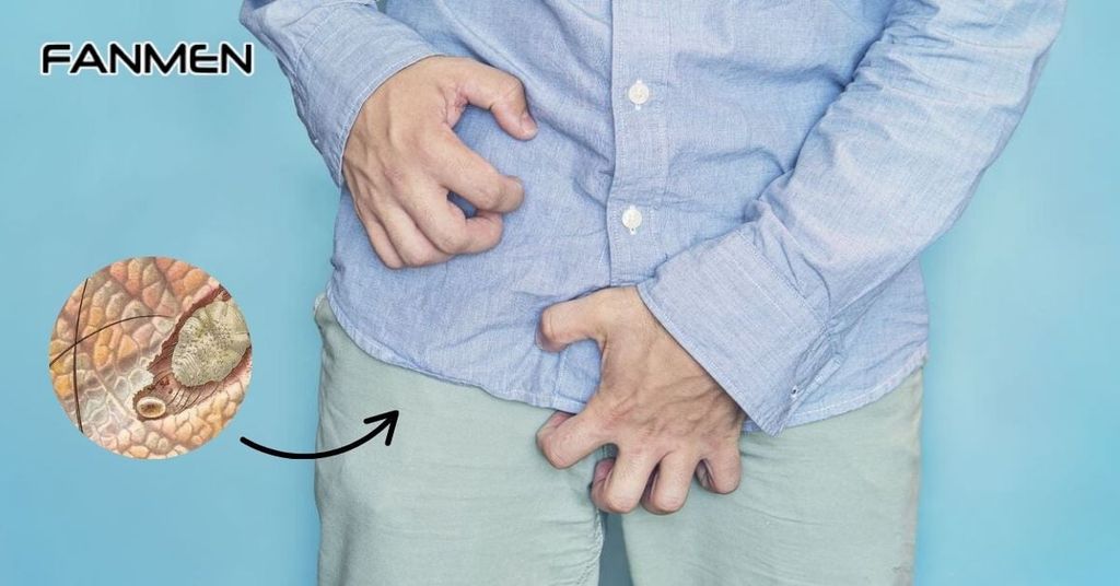 Nguyên nhân gây bệnh ghẻ ở vùng kín nam