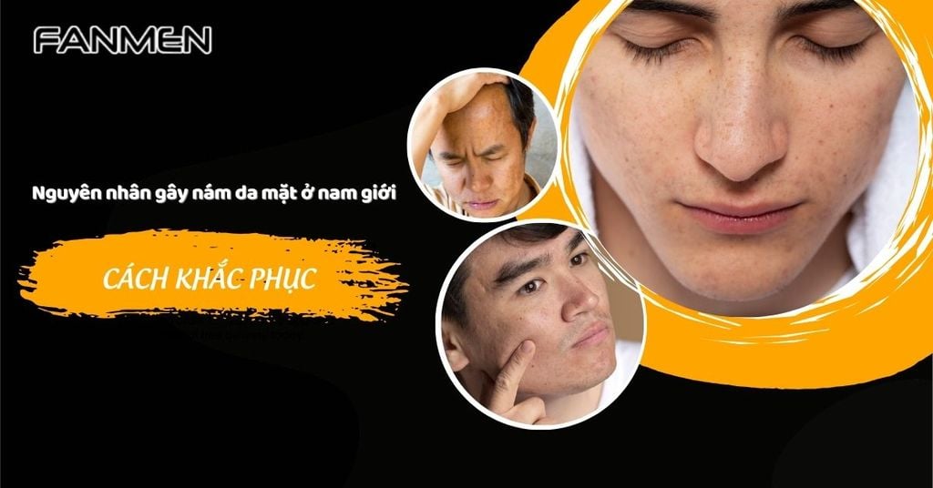 nguyên nhân gây nám da mặt ở nam giới