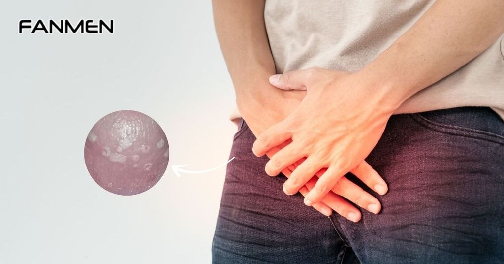 Do tình trạng viêm nhiễm