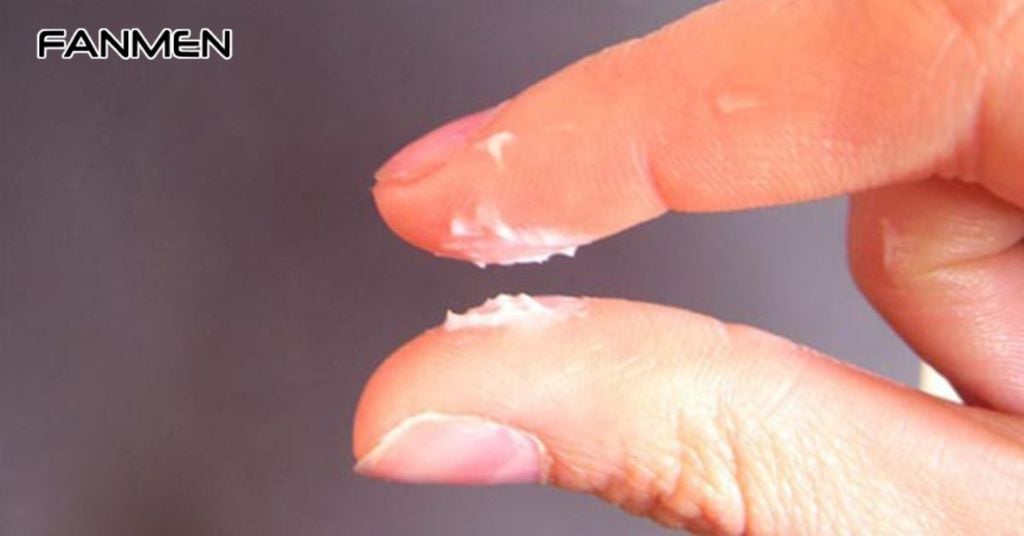 Nhiễm trùng nấm men (nấm Candida)