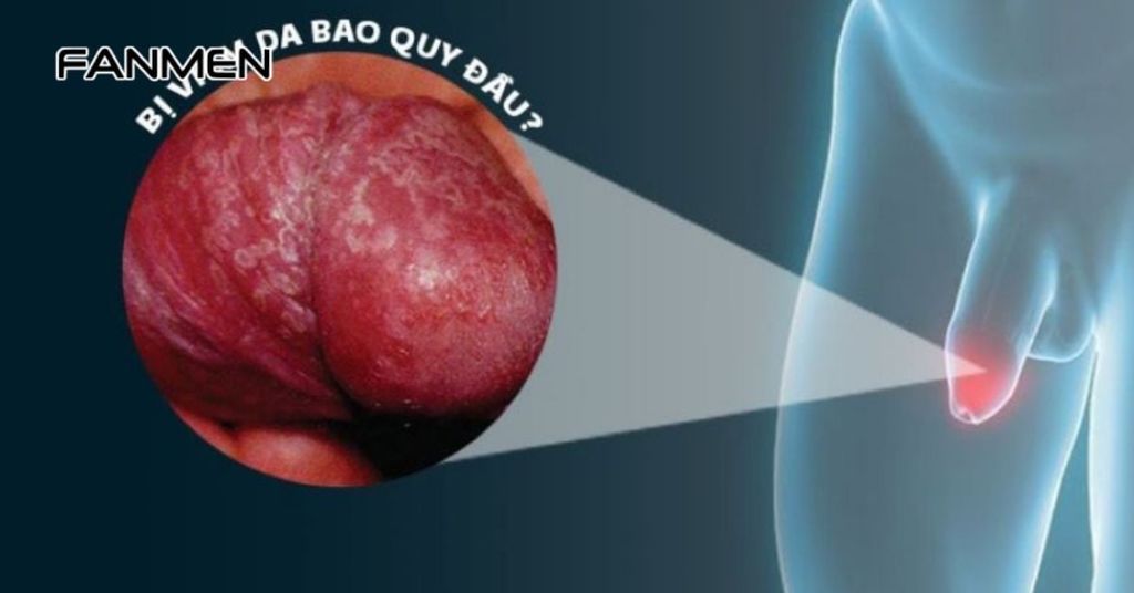 Những vấn đề thường gặp khi không biết vệ sinh vùng kín