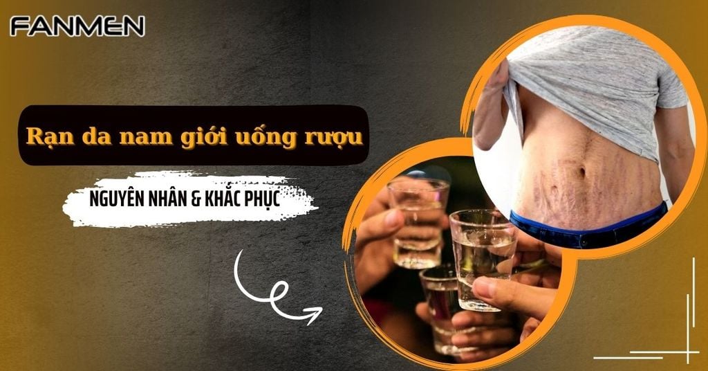 Rạn da nam giới uống rượu