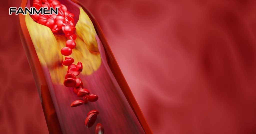 Rối loạn trao đổi chất