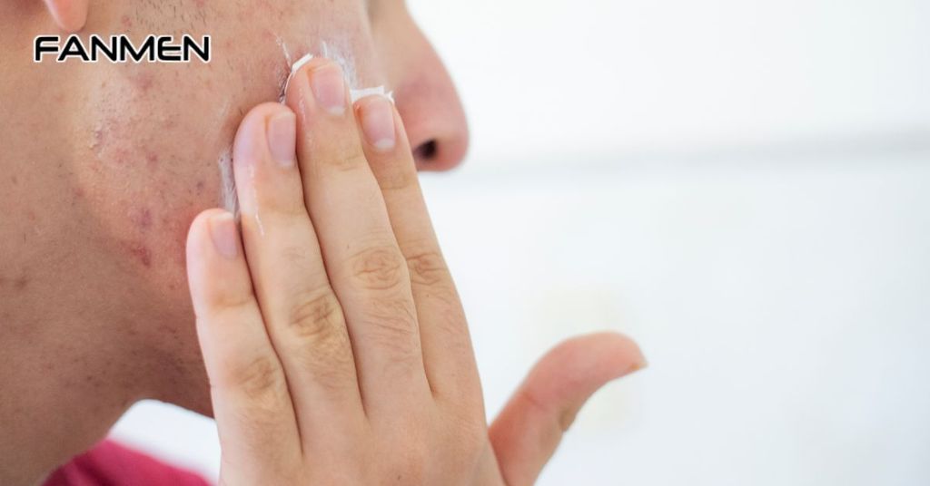 Sử dụng sản phẩm điều trị mụn cho nam