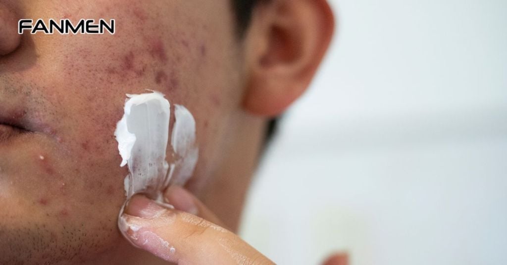 Tắc nghẽn lỗ chân lông