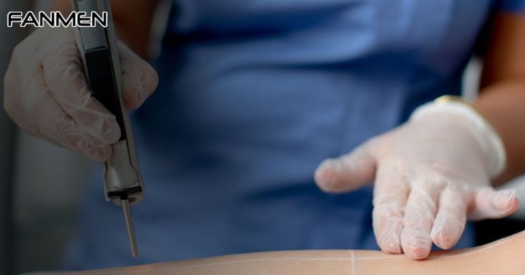 Tẩy lông bằng công nghệ cao