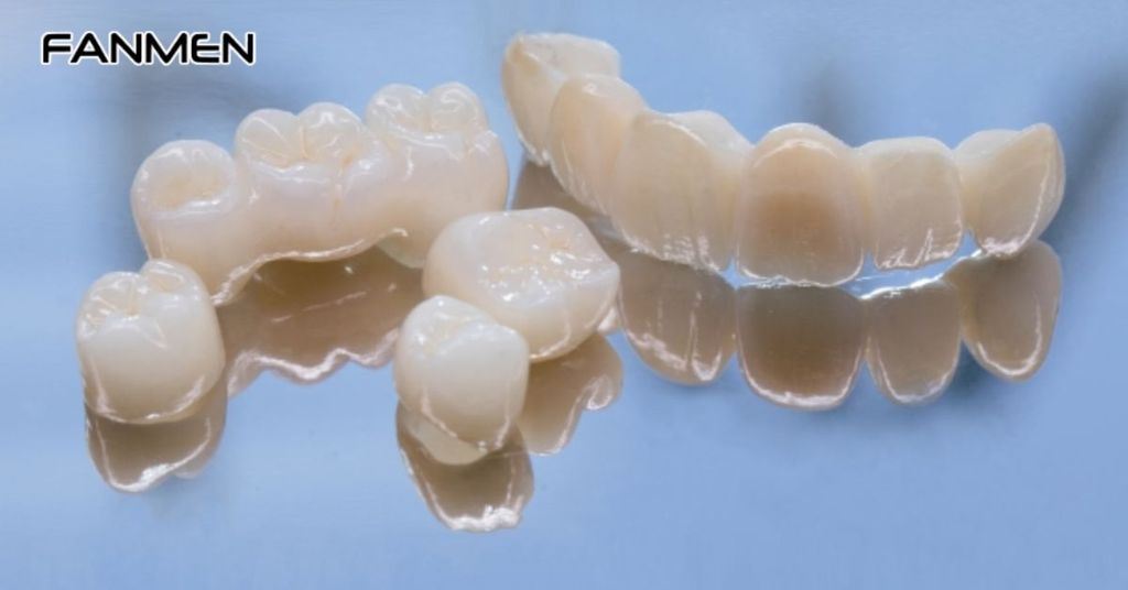 Thay răng sứ bằng kim loại bằng toàn sứ