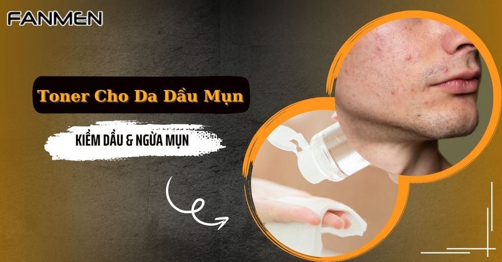 Toner cho da dầu mụn