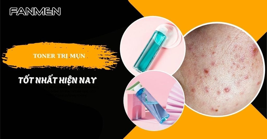 Toner trị mụn