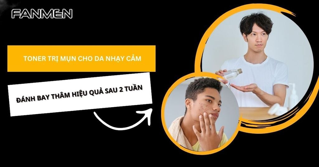 toner trị thâm mụn cho da nhạy cảm
