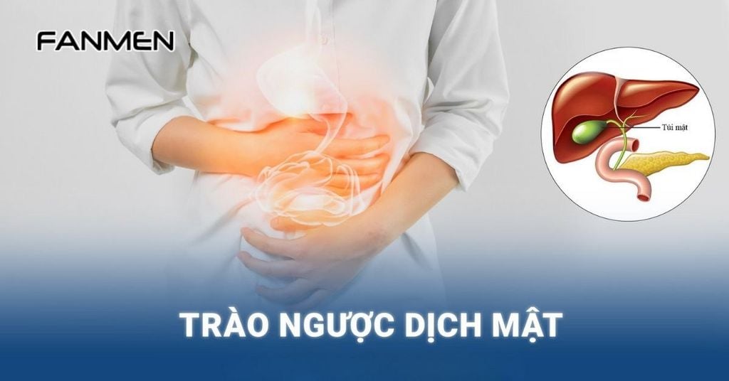 Bệnh trào ngược dịch mật