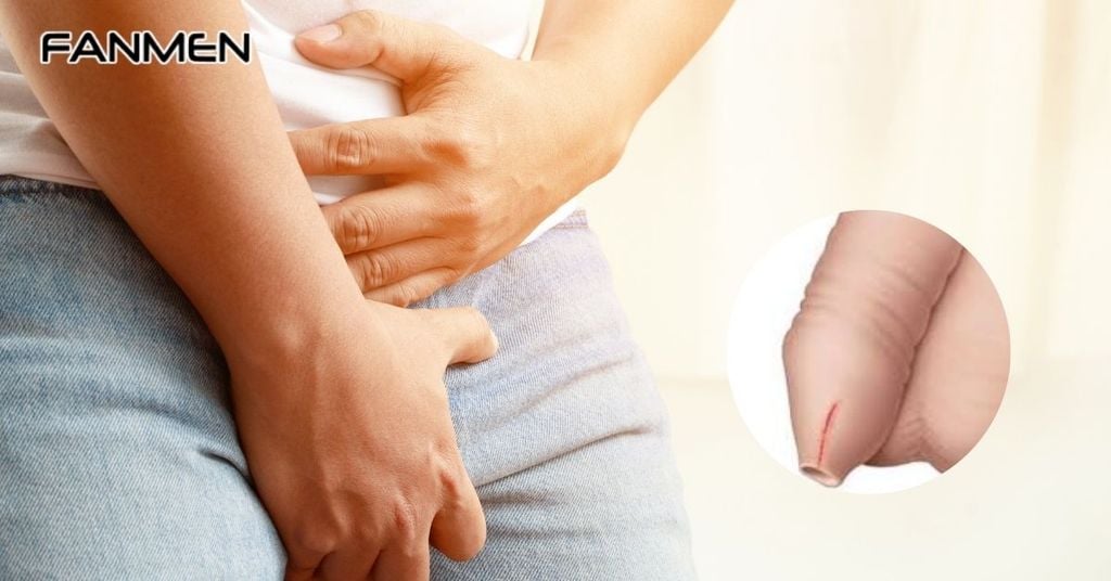 Khi vùng kín bị trầy xước nam giới nên làm gì?