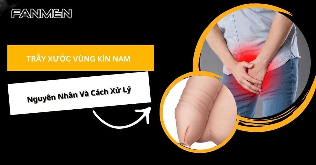 trầy xước vùng kín nam