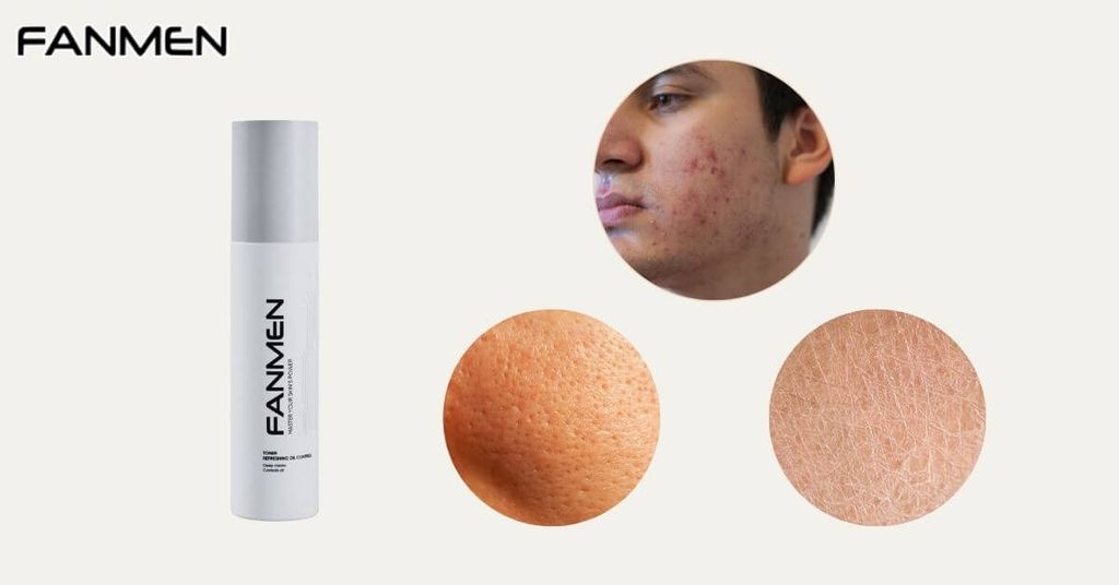 Vì sao cần sử dụng toner trong quy trình chăm sóc da nam giới?