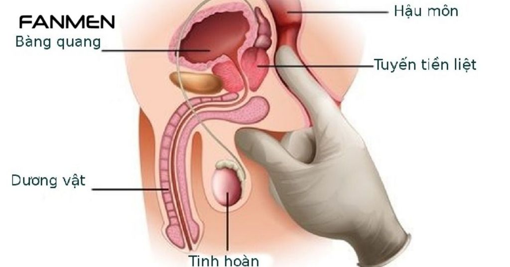 Tuyến tiền liệt