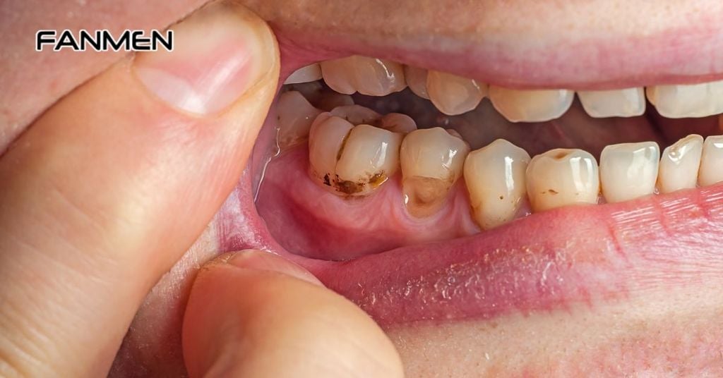 Do gặp vấn đề về răng miệng