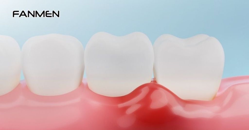 Do gặp vấn đề về răng miệng