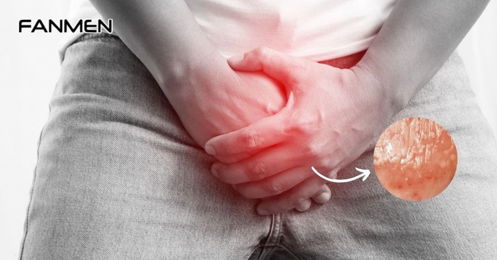 Viêm bao quy đầu