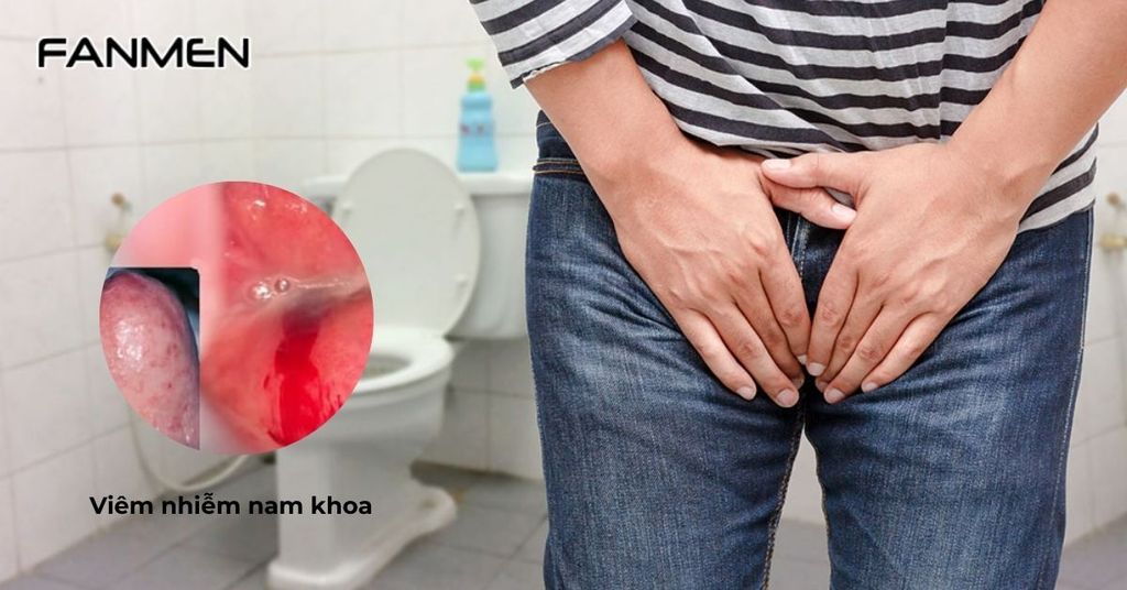 Viêm nhiễm nam khoa